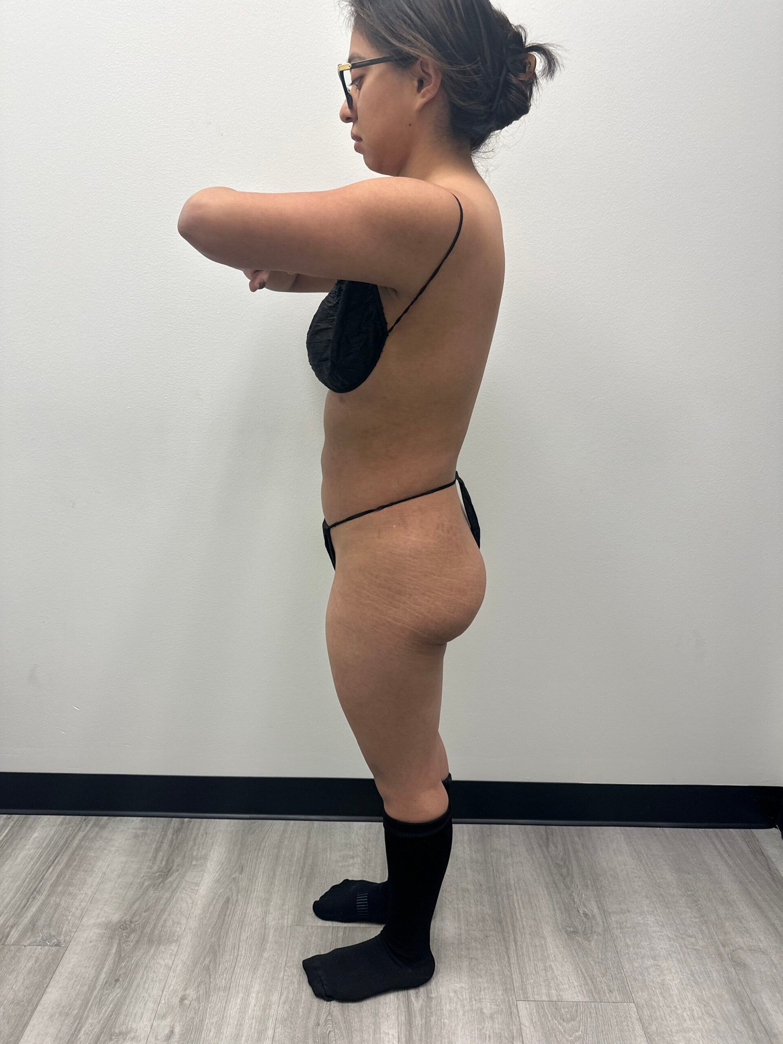 L- lipo bbl pre