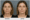 Before and After Result of Facial Rejuvenation