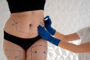 Is Fat Transfer Right for You? Discover the Benefits, Recovery, and Results of Brazilian Butt Lift in Jonesboro, Arkansas