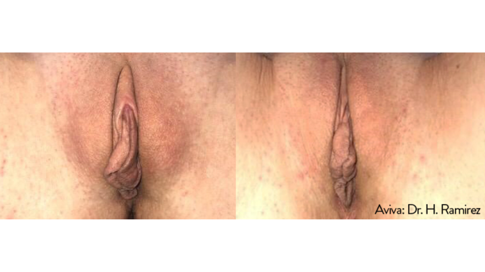 Sensitive Treatment 1