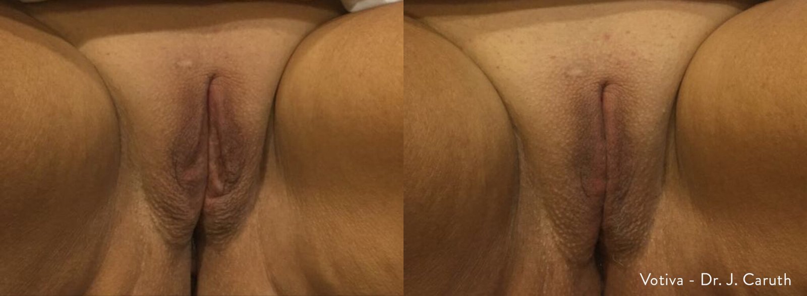 Sensitive Treatment 3