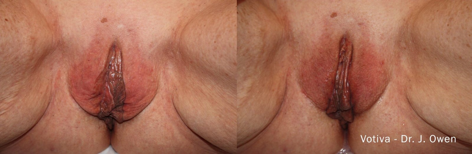 Sensitive Treatment 4