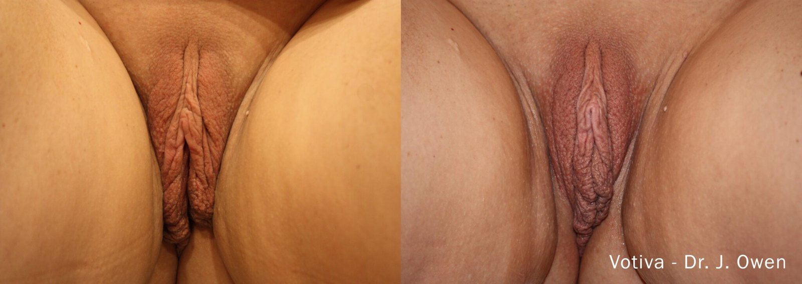 Sensitive Treatment 1