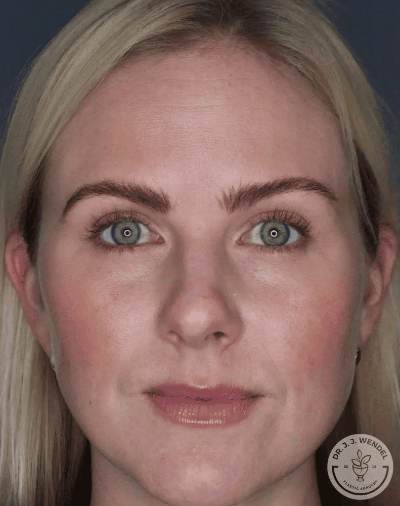 dummy-treatment-before