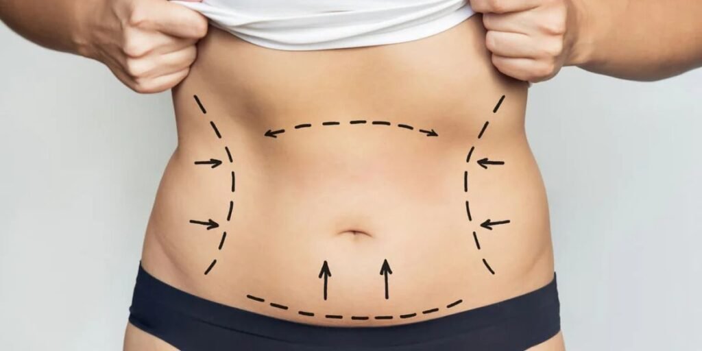 Cosmetic surgeon performing awake liposuction procedure on patient in a clinical setting with local anesthesia equipment, illustrating minimally invasive body contouring compared to general anesthesia procedures | Is Awake Liposuction Better Than General Anesthesia