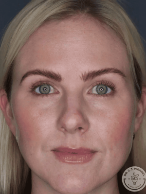 dummy-treatment-before